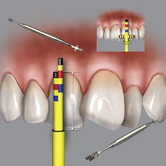Dentist Tools, Equipment & Supplies  